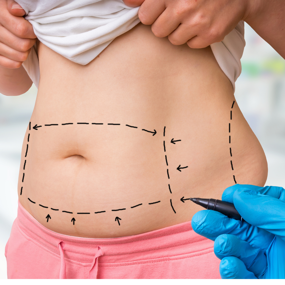 <h2>Better than Lipo Suction... Without the Price Tag or Needles </h2>